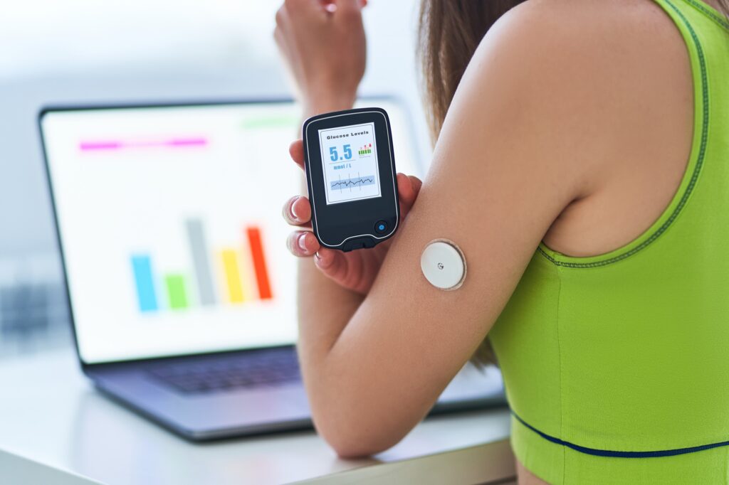 AI-Driven Glucose Monitoring